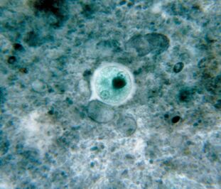 Dysenteric amoeba