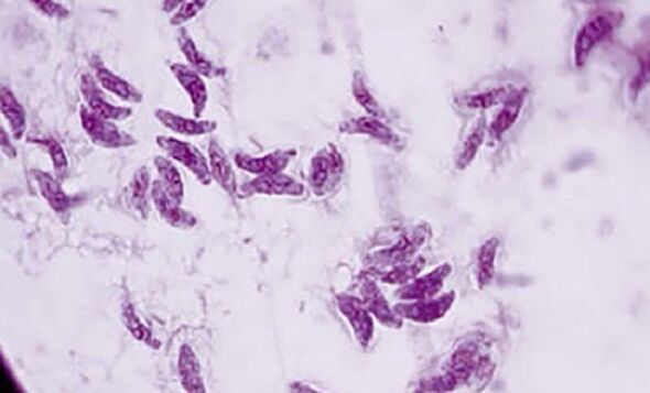 protozoan parasite toxoplasmosis gondii the causative agent of toxoplasmosis