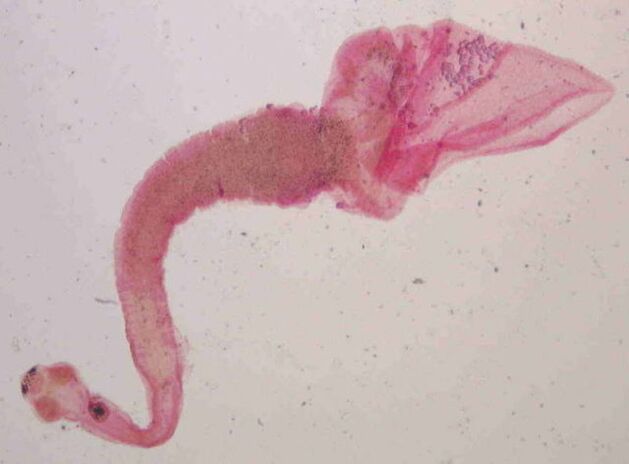 porcine tapeworm from the human body