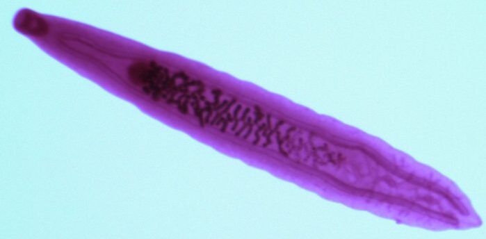 methyl parasite from the human body