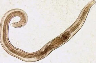 human parasites pinworms